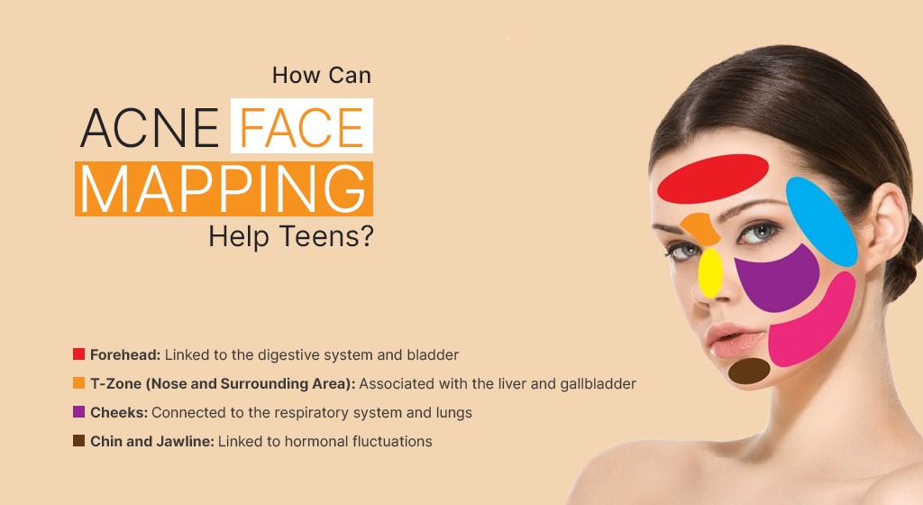 teens, acne, dermatologist