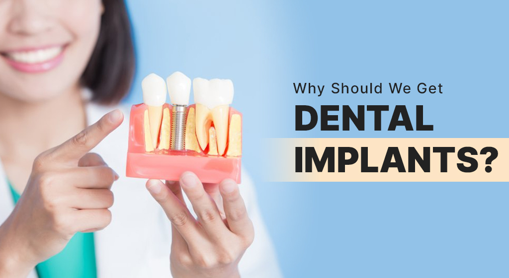 dental, implants