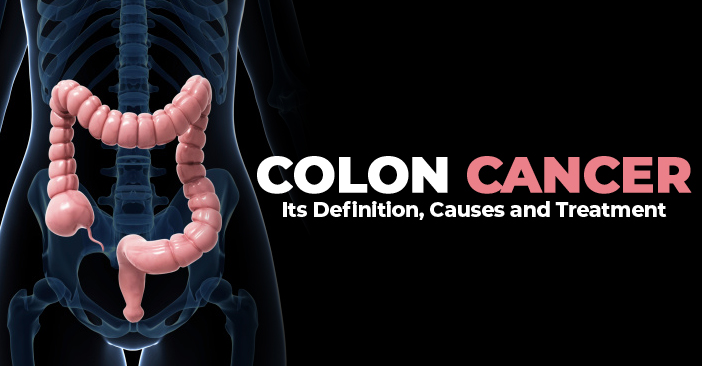 colon-cancer.jpg